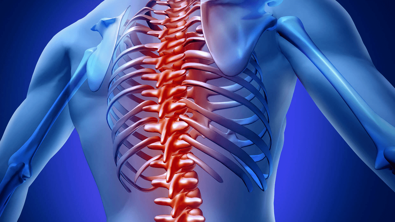 osteocondrose da columna vertebral torácica