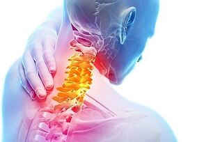 causas da osteocondrose cervical